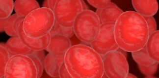 Novo tratamento para mieloma múltiplo é aprovado pela Anvisa Novo tratamento para mieloma múltiplo é aprovado pela Anvisa